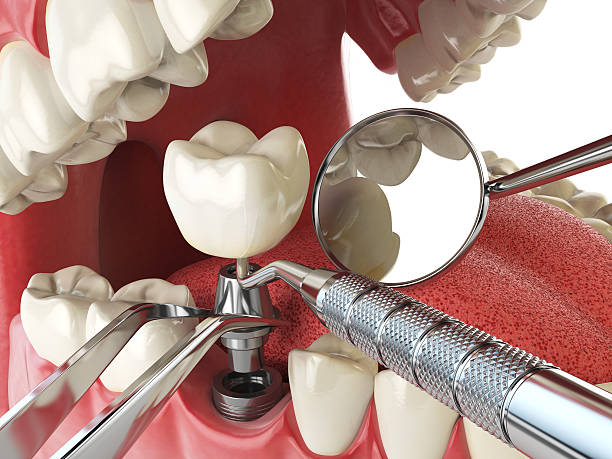 Best Pediatric Emergency Dentist in Telford, TN